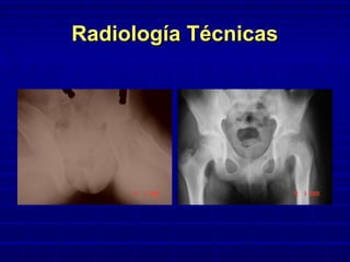 Radiología TécnicasRadiología Técnicas
 