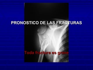 PRONOSTICO DE LAS FRACTURASPRONOSTICO DE LAS FRACTURAS
Toda fractura es graveToda fractura es grave
 