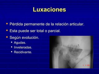 LuxacionesLuxaciones
 Pérdida permanente de la relación articular.Pérdida permanente de la relación articular.
 Esta puede ser total o parcial.Esta puede ser total o parcial.
 Según evolución.Según evolución.
 Agudas.Agudas.
 Inveteradas.Inveteradas.
 Recidivante.Recidivante.
 