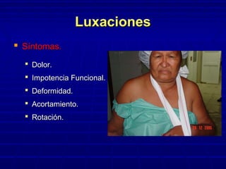 LuxacionesLuxaciones
 Síntomas.Síntomas.
 Dolor.Dolor.
 Impotencia Funcional.Impotencia Funcional.
 Deformidad.Deformidad.
 Acortamiento.Acortamiento.
 Rotación.Rotación.
 