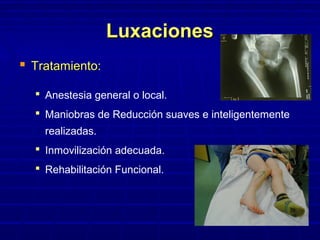 LuxacionesLuxaciones
 Tratamiento:Tratamiento:
 Anestesia general o local.
 Maniobras de Reducción suaves e inteligentemente
realizadas.
 Inmovilización adecuada.
 Rehabilitación Funcional.
 