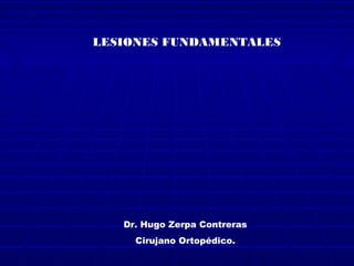 Dr. Hugo Zerpa Contreras
Cirujano Ortopédico.
LESIONES FUNDAMENTALES
 