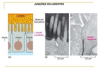 JUNÇÕES OCLUDENTES
 