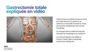 Cette technique est utilisée lorsque la tumeur
est située dans les 2/3 supérieurs de
l’estomac ou lorsqu’elle est située au niveau
de la jonction œsogastrique sans toucher
l’œsophage.
Le chirurgien retire la totalité de l’estomac,
une partie de l’œsophage et du duodénum.
La continuité digestive est rétablie en
suturant l’intestin grêle à l’œsophage
(anastomose oesojéjunal)
2023
Sebiha AYDOGAN
Léa DI LIBERATORE
 
