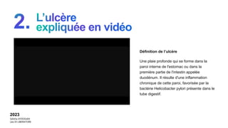 Une plaie profonde qui se forme dans la
paroi interne de l'estomac ou dans la
première partie de l'intestin appelée
duodénum. Il résulte d'une inflammation
chronique de cette paroi, favorisée par la
bactérie Helicobacter pylori présente dans le
tube digestif.
2023
Sebiha AYDOGAN
Léa DI LIBERATORE
Définition de l’ulcère
 