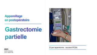 Si par laparotomie : souvent PCEA
2023
Sebiha AYDOGAN
Léa DI LIBERATORE
 