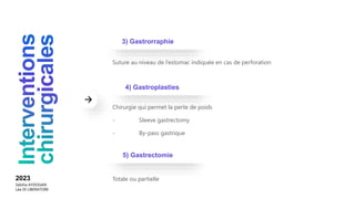 Suture au niveau de l’estomac indiquée en cas de perforation
Chirurgie qui permet la perte de poids
- Sleeve gastrectomy
- By-pass gastrique
3) Gastrorraphie
4) Gastroplasties
Totale ou partielle
5) Gastrectomie
2023
Sebiha AYDOGAN
Léa DI LIBERATORE
 