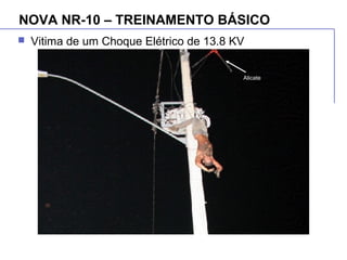 NOVA NR-10 – TREINAMENTO BÁSICO
 Vitima de um Choque Elétrico de 13.8 KV
Alicate
 