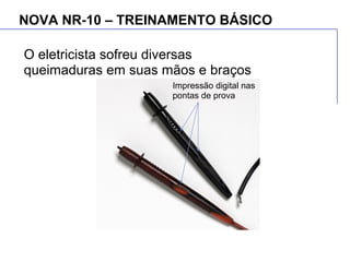 NOVA NR-10 – TREINAMENTO BÁSICO
O eletricista sofreu diversas
queimaduras em suas mãos e braços
Impressão digital nas
pontas de prova
 
