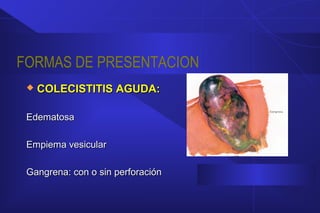 FORMAS DE PRESENTACION
 COLECISTITIS AGUDA:COLECISTITIS AGUDA:
EdematosaEdematosa
Empiema vesicularEmpiema vesicular
Gangrena: con o sin perforaciónGangrena: con o sin perforación
 