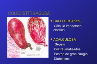 COLECISTITIS AGUDA
 CALCULOSA 95%CALCULOSA 95%
Cálculo impactadoCálculo impactado
císcticocísctico
 ACALCULOSAACALCULOSA
SepsisSepsis
PolitraumatizadosPolitraumatizados
Postop de gran cirugíaPostop de gran cirugía
DiabéticosDiabéticos
 