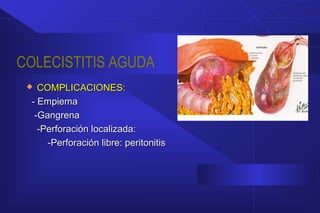 COLECISTITIS AGUDA
 COMPLICACIONES:COMPLICACIONES:
- Empiema- Empiema
-Gangrena-Gangrena
-Perforación localizada:-Perforación localizada:
-Perforación libre: peritonitis-Perforación libre: peritonitis
 