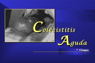 Colecistitis Aguda
ColelitiasisColelitiasis
Litos resultado de sólidos biliaresLitos resultado de sólidos biliares
precipi...