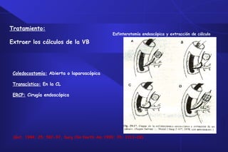 Esfinterotomía endoscópica y extracción de cálculo
Tratamiento:
Extraer los cálculos de la VB
Coledocostomía: Abierta o laparoscópica
Transcístico: En la CL
ERCP: Cirugía endoscópica
(Gut, 1984; 25: 587-97, Surg Clin North Am 1990; 70: 1313-28)
 