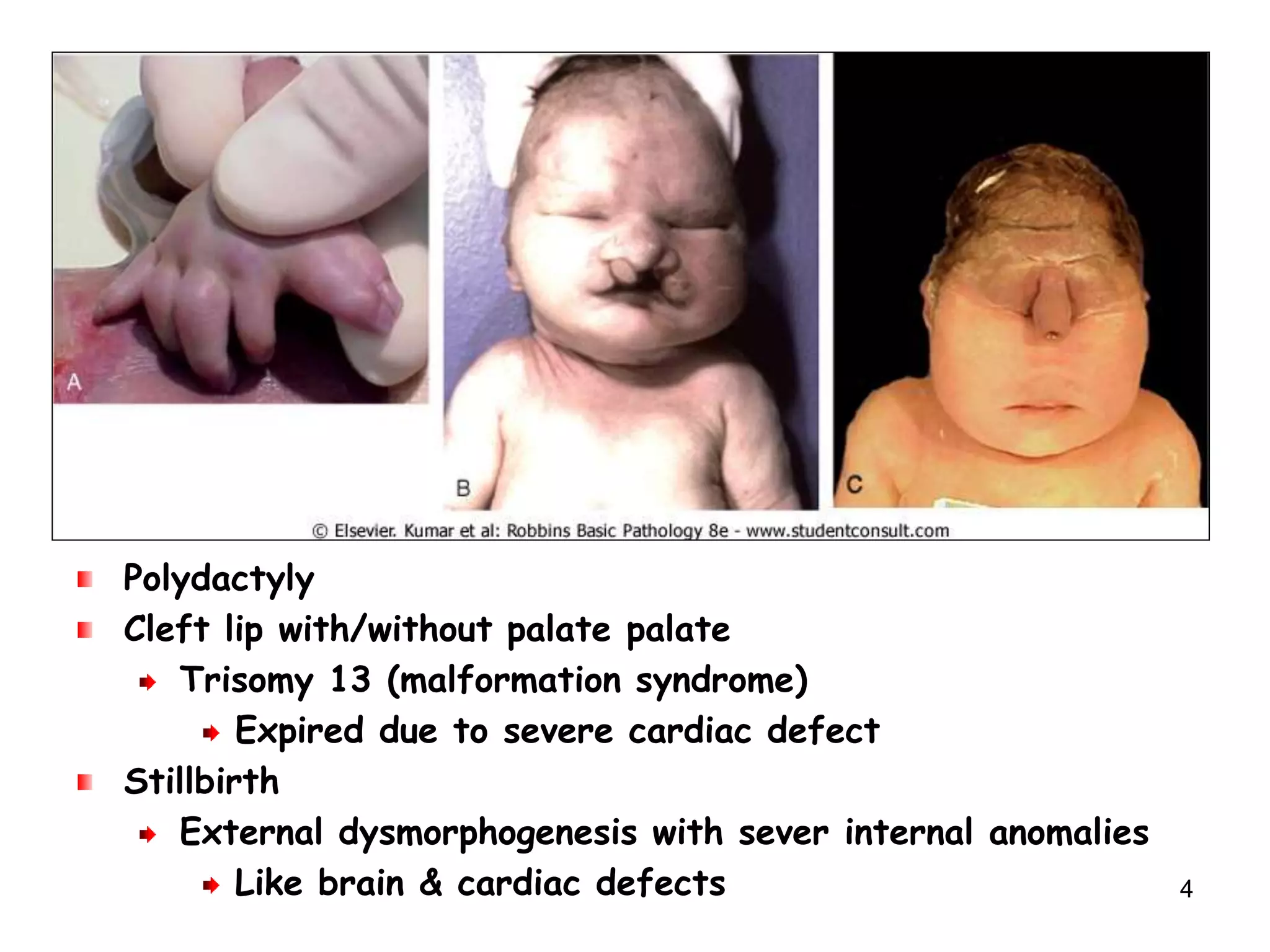 Pediatric diseases | PPT