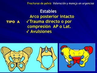 TIPO A
Estables
Arco posterior intacto
✓Trauma directo o por
compresión AP o Lat.
✓ Avulsiones
Fracturas de pelvis Valoración y manejo en urgencias
 