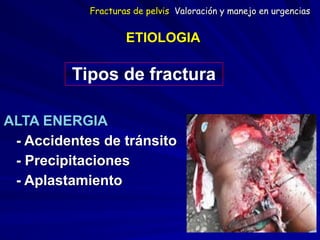 ETIOLOGIA  
ALTA ENERGIA
- Accidentes de tránsito
- Precipitaciones
- Aplastamiento
Tipos de fractura
Fracturas de pelvis Valoración y manejo en urgencias
 