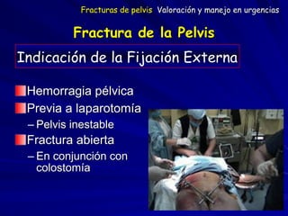Fractura de la Pelvis
Hemorragia pélvica
Previa a laparotomía
– Pelvis inestable
Fractura abierta
– En conjunción con
colostomía
Indicación de la Fijación Externa
Fracturas de pelvis Valoración y manejo en urgencias
 