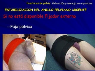 ESTABILIZACION DEL ANILLO PELVIANO URGENTE 
Si no está disponible Fijador externo
–Faja pélvica
Fracturas de pelvis Valoración y manejo en urgencias
 