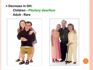 pituitary dwarfism family