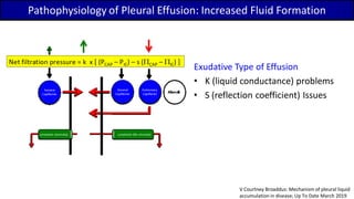 Pathophysiology of Pleural Effusion: Increased Fluid Formation
Exudative Type of Effusion
• K (liquid conductance) problems
• S (reflection coefficient) Issues
V Courtney Broaddus: Mechanism of pleural liquid
accumulation in disease; Up To Date March 2019
 