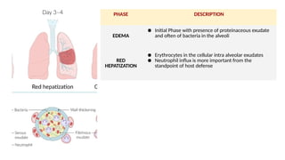 PHASE DESCRIPTION
EDEMA
● Initial Phase with presence of proteinaceous exudate
and often of bacteria in the alveoli
RED
HEPATIZATION
● Erythrocytes in the cellular intra alveolar exudates
● Neutrophil influx is more important from the
standpoint of host defense
 