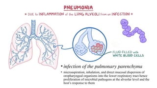 • infection of the pulmonary parenchyma
• microaspiration, inhalation, and direct mucosal dispersion of
oropharyngeal organisms into the lower respiratory tract hence
proliferation of microbial pathogens at the alveolar level and the
host’s response to them
 