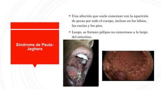 Síndrome de Peutz-
Jeghers
 Una afección que suele comenzar con la aparición
de pecas por todo el cuerpo, incluso en los labios,
las encías y los pies.
 Luego, se forman pólipos no cancerosos a lo largo
del intestino.
 