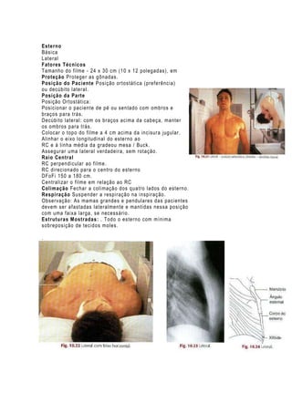 Esterno
Básica
Lateral
Fatores Técnicos
Tamanho do filme - 24 x 30 cm (10 x 12 polegadas), em
Proteção Proteger as gônadas.
Posição do Paciente Posição ortostática (preferência)
ou decúbito lateral.
Posição da Parte
Posição Ortostática:
Posicionar o paciente de pé ou sentado com ombros e
braços para trás.
Decúbito lateral: com os braços acima da cabeça, manter
os ombros para trás.
Colocar o topo do filme a 4 cm acima da incisura jugular.
Alinhar o eixo l ongitudi nal do esterno ao
RC e à linha média da gradeou mesa / Buck.
Assegurar uma l ateral v erdadeira, sem rotação.
Raio Central
RC perpendicular ao fil me.
RC direcionado para o c entro do esterno
DFoFi 150 a 180 cm.
Centralizar o filme em relação ao RC
Colimação Fechar a coli mação dos quatro lados do esterno.
Respiração Sus pender a respiraç ão na inspiração.
Observação: As mamas grandes e pendulares das pacientes
devem ser afastadas lateralmente e mantidas nessa posição
com uma faixa larga, se necessário.
Estruturas Mostradas: . Todo o esterno com mínima
sobreposição de tecidos moles.
.

 