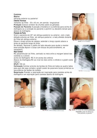 Costelas
Básica
oblíquas anterior ou pos terior
Fatores Técnicos
Tamanho do filme - 35 x 43 cm, em sentido longitudinal
Proteção Coloc ar protetor de chumbo sobre as gônadas.
Posição do Paciente A posição ortostática é a preferida para acima do
diafragma se a condição do paciente o permitir ou decúbito dorsal para
abaixo do di afragma.
Posição da Parte
Girar o paciente em 45° em oblíqua posterior ou anterior, com o lado
afetado próximo ao filme em oblíqua posterior, e lado afetado distante
do filme em oblíqua anterior.
Elevar o braço acima da cabeça; estender o braç o oposto abaixo e
atrás do paciente longe do tórax .
Se deitado, flexionar o j oelho do l ado elevado para ajudar a manter
essa posição.Apoiar o c orpo com blocos de posicionamento, se
necessário.
Raio Central
RC perpendicular ao fil me, centrado no meio entre a margem lateral das
costelas e a c oluna
acima do Diafragma: RC 4 cm acima dos ombros
Abaixo do Diafragma:RC ao nível do meio entre o xifóide e o gradil costa
Inferior.
DFoFi 100 cm
Colimação Colimar pr óximo às bordas do filme em todos os quatro lados
para que não sej a cortado o gradil costa I de possíveis locais primários ou
secundários de lesões da costela.
Respiração Prender a respiração em inspiração para costelas acima do
diafragma e em expi ração para costelas abaixo do diafragma .

 