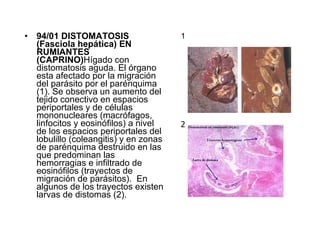 94/01 DISTOMATOSIS (Fasciola hepática) EN RUMIANTES (CAPRINO) Hígado con distomatosis aguda. El órgano esta afectado por la migración del parásito por el parénquima (1). Se observa un aumento del tejido conectivo en espacios periportales y de células mononucleares (macrófagos, linfocitos y eosinófilos) a nivel de los espacios periportales del lobulillo (coleangitis) y en zonas de parénquima destruido en las que predominan las  hemorragias e infiltrado de eosinófilos (trayectos de migración de parásitos).  En algunos de los trayectos existen larvas de distomas (2). 1 2 