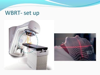 WBRT- set up
 
