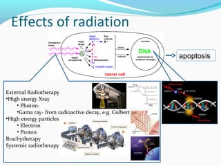 Effects of radiation
External Radiotherapy
•High energy Xray
• Photon-
•Gama ray- from radioactive decay, e.g. Colbert
•High energy particles
• Electron
• Proton
Brachytherapy
Systemic radiotherapy
apoptosis
 