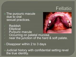 Palatal petechiae