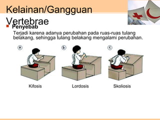 Kelainan/Gangguan
Vertebrae Penyebab
Terjadi karena adanya perubahan pada ruas-ruas tulang
belakang, sehingga tulang belakang mengalami perubahan.
 