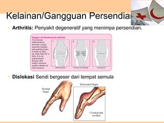 Kelainan/Gangguan Persendian
• Arthritis: Penyakit degeneratif yang menimpa persendian.
• Dislokasi Sendi bergeser dari tempat semula
 