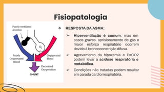 Fisiopatologia
❖ RESPOSTA DA ASMA:
➢ Hiperventilação é comum, mas em
casos graves, aprisionamento de gás e
maior esforço respiratório ocorrem
devido à broncoconstrição difusa.
➢ Agravamento da hipoxemia e PaCO2
podem levar a acidose respiratória e
metabólica.
➢ Condições não tratadas podem resultar
em parada cardiorrespiratória.
 