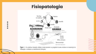 Fisiopatologia
 