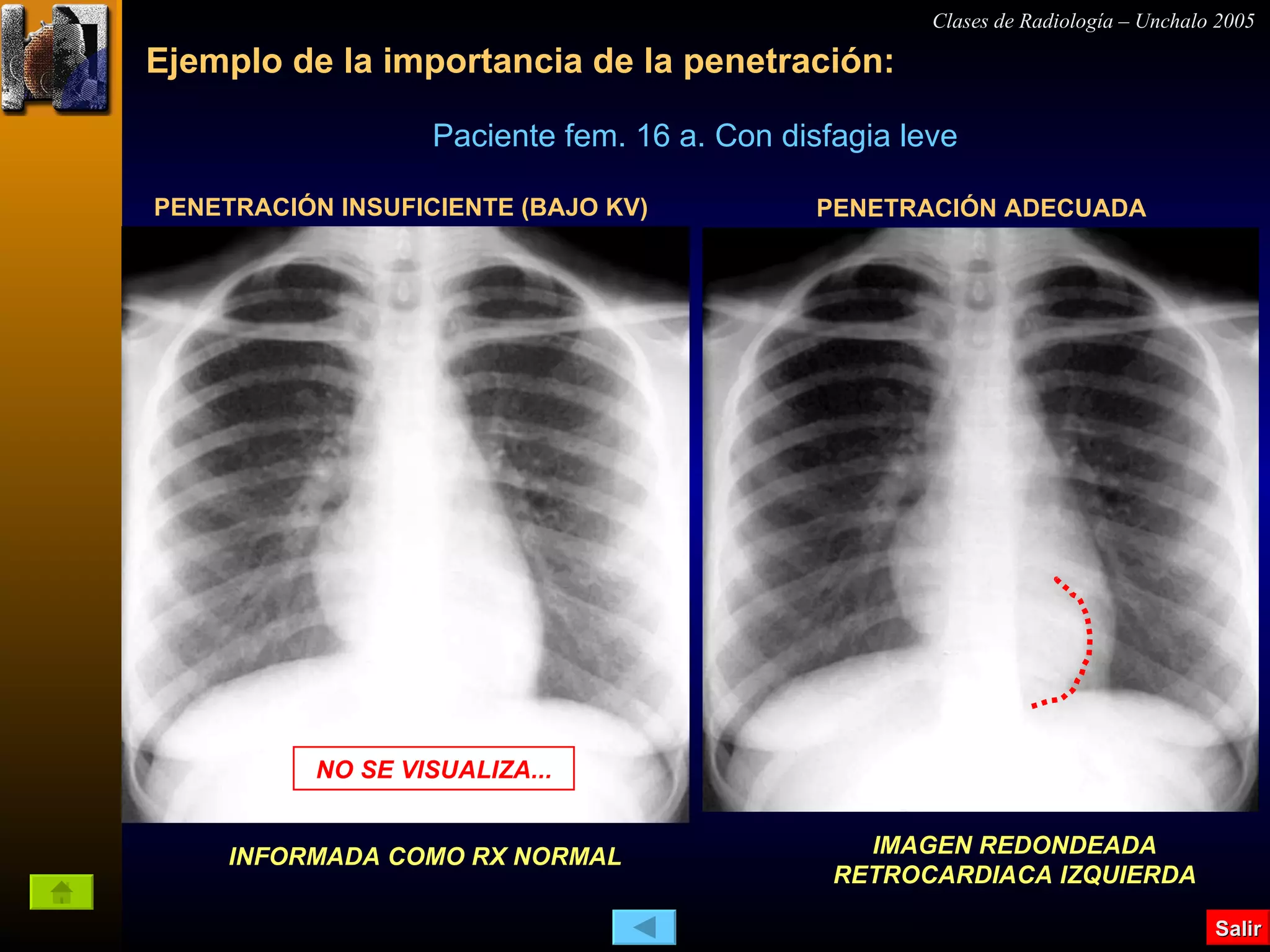 Como interpretar una rx en pediatría. | PPS