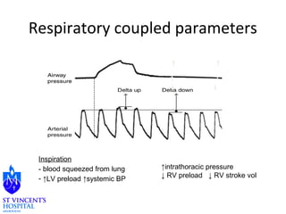 Respiratory coupled parameters 
SPV 
Inspiration 
- blood squeezed from lung 
- ↑LV preload ↑systemic BP 
↑intrathoracic pressure 
↓ RV preload ↓ RV stroke vol 
 