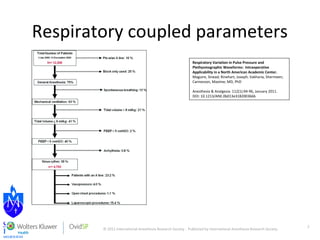 Respiratory coupled parameters 
© 2011 International Anesthesia Research Society . Published by International Anesthesia Research Society. 
2 
Respiratory Variation in Pulse Pressure and 
Plethysmographic Waveforms: Intraoperative 
Applicability in a North American Academic Center. 
Maguire, Sinead; Rinehart, Joseph; Vakharia, Shermeen; 
Cannesson, Maxime; MD, PhD 
Anesthesia & Analgesia. 112(1):94-96, January 2011. 
DOI: 10.1213/ANE.0b013e318200366b 
 