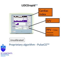 LiDCOrapidTM 
Uncalibrated 
Cardiac 
Index 
SVV 
PPV - Pulse 
Pressure 
Variation 
Proprietary algorithm - PulseCOTM 
 