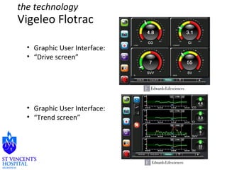 the technology 
Vigeleo Flotrac 
• Graphic User Interface: 
• “Drive screen” 
• Graphic User Interface: 
• “Trend screen” 
 