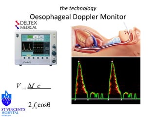V = Df c . 
2 ft cosq 
the technology 
Oesophageal Doppler Monitor 
 
