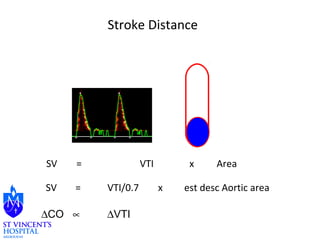 Stroke Distance 
SV = VTI x Area 
SV = VTI/0.7 x est desc Aortic area 
DCO µ DVTI 
 