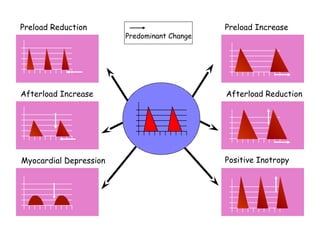 Preload Reduction Preload Increase 
Predominant Change 
Afterload Increase Afterload Reduction 
Myocardial Depression Positive Inotropy 
 