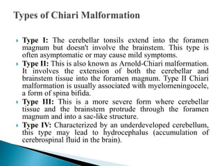  Type I: The cerebellar tonsils extend into the foramen
magnum but doesn't involve the brainstem. This type is
often asymptomatic or may cause mild symptoms.
 Type II: This is also known as Arnold-Chiari malformation.
It involves the extension of both the cerebellar and
brainstem tissue into the foramen magnum. Type II Chiari
malformation is usually associated with myelomeningocele,
a form of spina bifida.
 Type III: This is a more severe form where cerebellar
tissue and the brainstem protrude through the foramen
magnum and into a sac-like structure.
 Type IV: Characterized by an underdeveloped cerebellum,
this type may lead to hydrocephalus (accumulation of
cerebrospinal fluid in the brain).
 