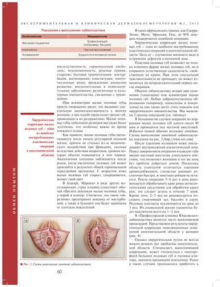 Э К С П Е Р И М Е Н Т А Л Ь Н А Я И К Л И Н И Ч Е С К А Я Д Е Р М А Т О К О С М Е Т О Л О Г И Я № 2 , 2 0 1 2 
наследственность; гормональный дисба- 
ланс; недоношенность; родовая травма; 
старение; бытовая травматизация; мастур- 
бация, вытягивания; конституция; много- 
численные роды; врожденные аномалии 
развития; воспалительные и невоспали- 
тельные заболевания; религиозные и куль- 
турные вмешательства, связанные с тради- 
циями. 
Хирургическая 
коррекция малых 
половых губ – одна 
из наиболее 
востребованных 
пластических 
операций 
в аногенитальной 
области 
60 О Б М Е Н О П Ы Т О М 
При асимметрии малые половые губы 
просто сморщенно висят, что вызывает сек- 
суальную закомплексованность у многих 
женщин, а при ходьбе происходит трение губ, 
приводящее к их раздражению. Малые поло- 
вые губы небольших размеров выглядят более 
эстетично, что особенно важно во время 
пляжного сезона. 
Как правило, малые половые губы увели- 
чиваются после начала регулярной половой 
жизни, причем не столько из-за механиче- 
ского воздействия при фрикциях, сколько 
вследствие действия андрогенов, уровень ко- 
торых обычно повышается в этот период. 
Аналогичная ситуация наблюдается после 
родов, когда увеличение половых губ может 
произойти в результате общей гормональной 
перестройки организма. С возрастом кожа 
малых половых губ стареет, сморщивается, 
меняет свой цвет. 
В Алжире, Марокко и ряде других му- 
сульманских стран издавна существует обы- 
чай обрезать девушкам малые половые губы, 
а порой и клитор. Считается, что такое «об- 
резание» предохранит девушку от мастурба- 
ций, а также в будущем она будет защищена 
от плотских вожделений. 
В таких африканских странах, как Сьерра- 
Леоне, Мали, Эфиопия, Гана, до 90% деву- 
шек подвергаются подобной операции. 
Хирургическая коррекция малых поло- 
вых губ – одна из наиболее востребованных 
пластических операций в аногенитальной об- 
ласти. Цель ее – улучшение внешнего вида и 
устранение дефектов в интимной зоне. 
Пластика половых губ позволяет не толь- 
ко изменить форму малых половых губ, но и 
сохранить естественную складчатость, свой- 
ственную их краям. При этом сексуальная 
чувствительность не пропадает, но может из- 
меняться на непродолжительный период по- 
сле операции. 
Обычно лабиопластику делают при удли- 
нении (элонгации) или асимметрии малых 
половых губ. Любые доброкачественные об- 
разования (например, папилломы и конди- 
ломы) на них также могут стать поводом для 
хирургического вмешательства. Мы выделя- 
ем 2 группы показаний (см. таблицу). 
В большинстве случаев операция по кор- 
рекции малых половых губ длится около 40 
мин и проводится под местной анестезией. 
Избытки тканей обычно иссекают линейно. 
Схемы выполнения линейной лабиопласти- 
ки показаны на рис. 3 [http://www.wix.com]. 
После удаления излишков кожи накла- 
дывают внутрикожный косметический шов. 
Перед завершением операции в каждую губу 
вводят местный анестетик длительного дей- 
ствия, что позволяет женщине в тот же день 
без проблем добраться домой. Поскольку 
область гениталий отличается хорошим 
кровоснабжением, слизистая заживает до- 
статочно быстро, и заметных рубцов не оста- 
ется. После операции 5–6 раз в день реко- 
мендуется обрабатывать края раны антисеп- 
тическими средствами для обработки краев 
ран; это следует делать в течение 7 дней. 
Кроме того, 2–3 нед не рекомендуется по- 
сещать спортивный зал, бассейн и сауну. 
Половые контакты исключаются на срок до 
3 нед. Из социальной жизни пациентка бу- 
дет выключена всего на 1–2 дня. 
В «Профессорской клинике Юцковских» 
лабиопластика является часто выполняемой 
процедурой. Представляем результаты хирур- 
гической коррекции инволюционных изме- 
нений аногенитальной области у женщин 
(рис. 4). 
Однако хирургическим путем не всегда 
можно решить все проблемы аногениталь- 
ной области. Специалист, выполняющий 
коррекцию, может столкнуться с гипотро- 
фией больших половых губ и головки кли- 
тора, зиянием преддверия влагалища. Ранее 
в таких случаях приходилось прибегать к 
Показания к выполнению лабиопластики 
Эстетические Медицинские 
Желание пациентки 
Травматизация 
(например, бельем) 
Комплексы Частое воспаление 
Асимметрия Трудности в интимной жизни 
а б 
Рис. 3. Схемы выполнения линейной лабиопластики 
 