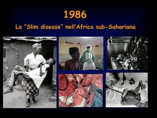 1986
La “Slim disease” nell’Africa sub-Sahariana
 