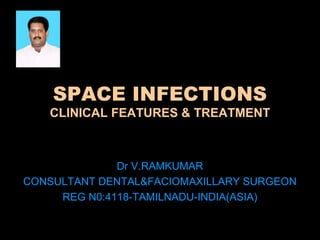 SPACE INFECTIONS 
CLINICAL FEATURES & TREATMENT 
Dr V.RAMKUMAR 
CONSULTANT DENTAL&FACIOMAXILLARY SURGEON 
REG N0:4118-TAMILNADU-INDIA(ASIA) 
 